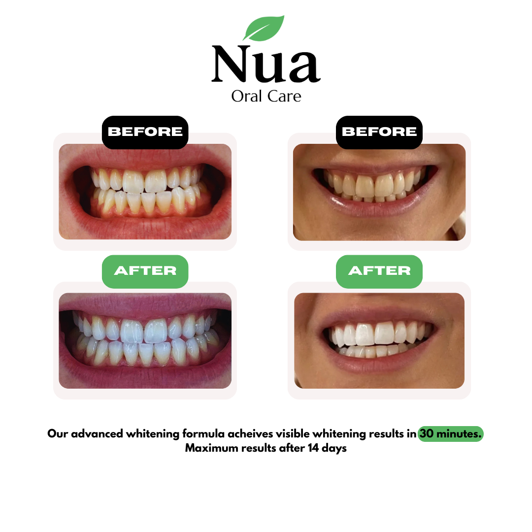 PAP Teeth Whitening Strips With Hydroxyapatite